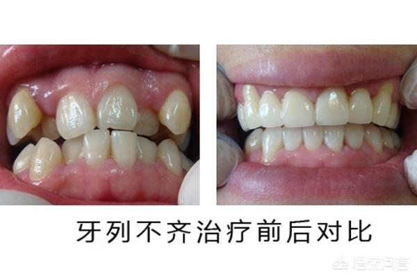 详细阅读:安溪最新24小时牙医在线咨询方法分析(最方便真实的安溪有没有24小时牙医方法) 安溪最新24小时牙医在线咨询方法分析(最方便真实的安溪有没有24小时牙医方法)