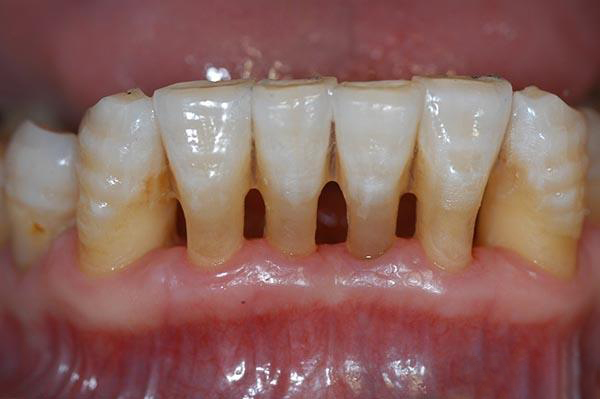 安溪最新24小时牙医在线咨询方法分析(最方便真实的安溪有没有24小时牙医方法)